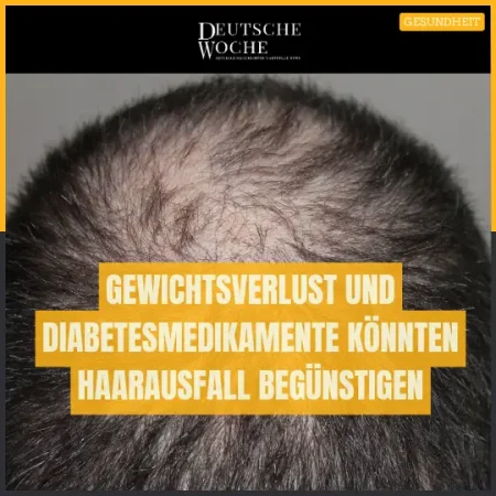 Gewichtsverlust und Diabetesmedikamente könnten Haarausfall begünstigen: Studie
